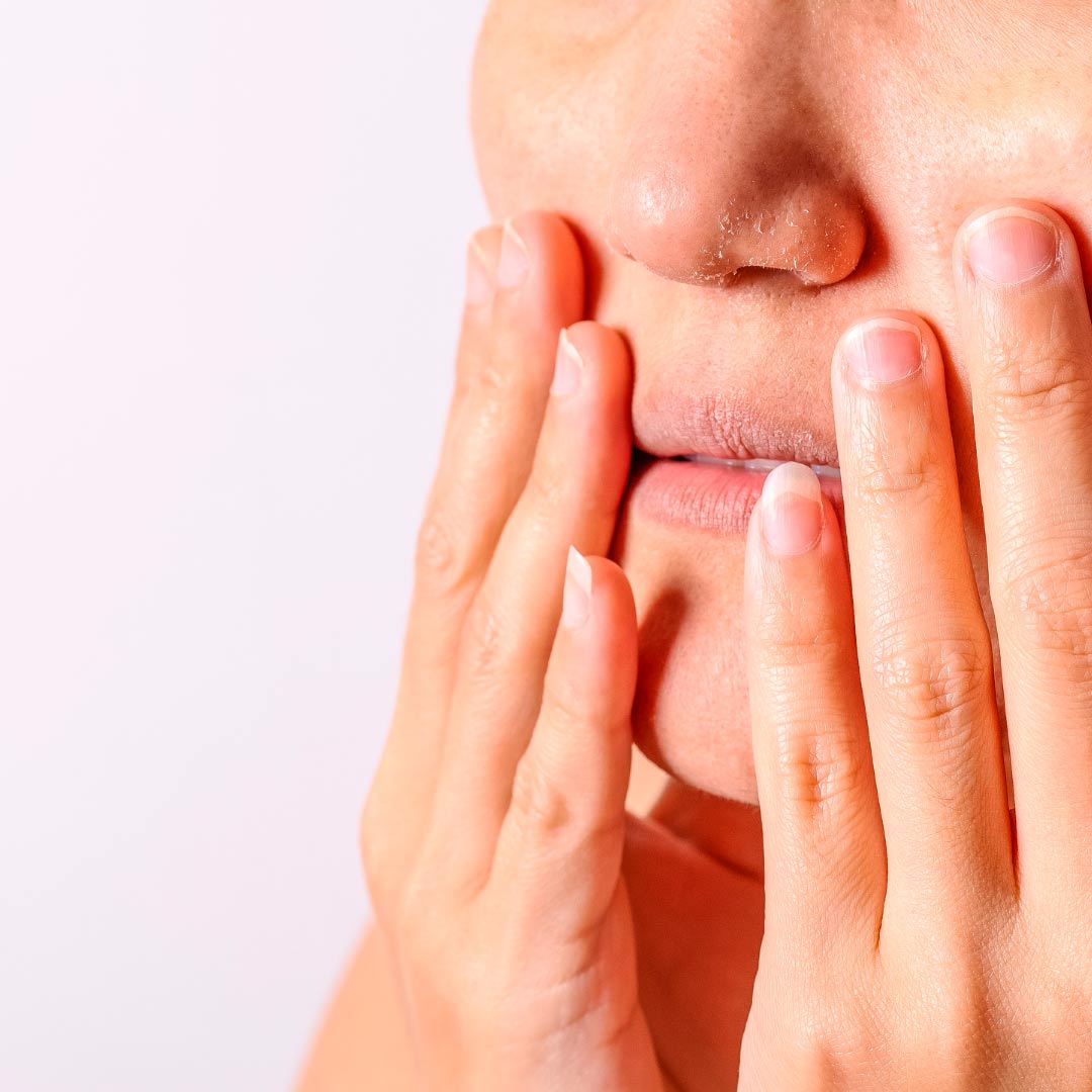 Mujer con labios agrietados por el frío